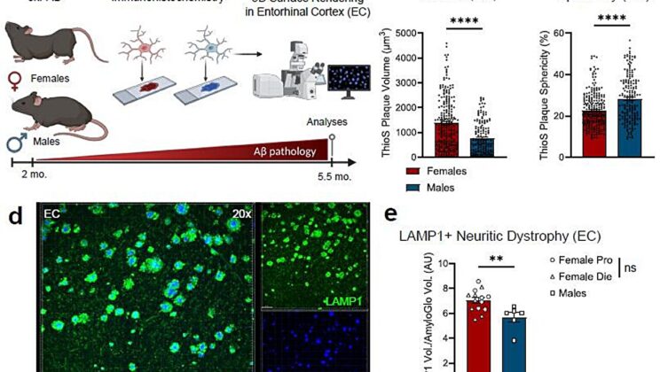 Scientists Finally Uncover Why Alzheimer’s Hits Women Harder Than Men