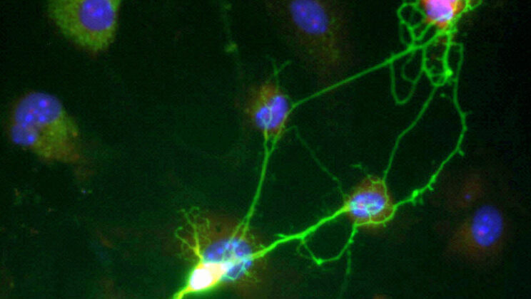 Scientists Discover a Ticking Biological Clock in Your Blood That Predicts Brain Decay