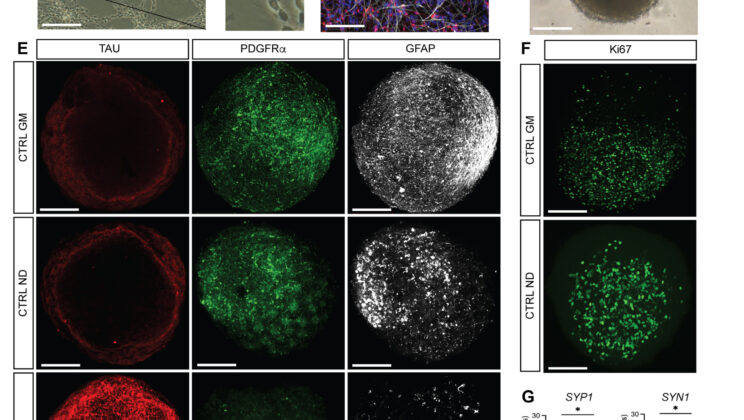 The Brain’s “Rapid-Braking” System Can Now Be Lab-Grown—Without Using Stem Cells