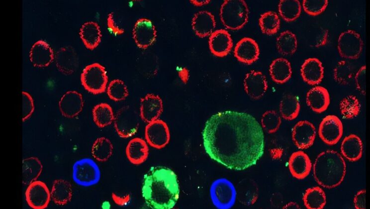 Skin Cancer Cells Are Firing Microscopic Missiles to Kill Immune Cells Before They Can Attack